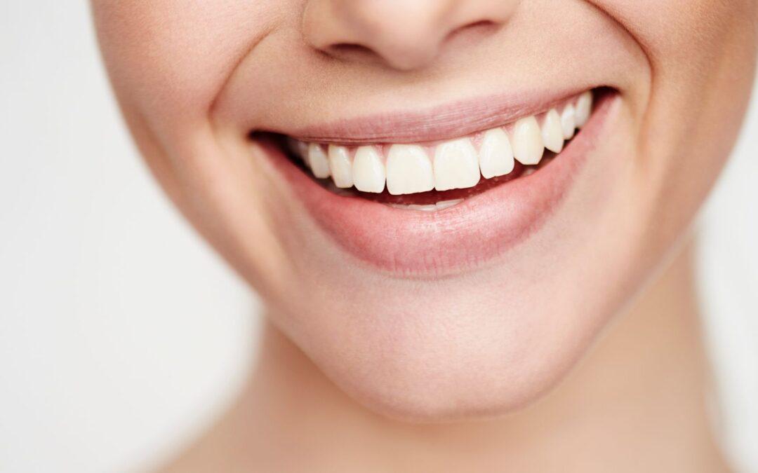 Sonrisa, estética dental