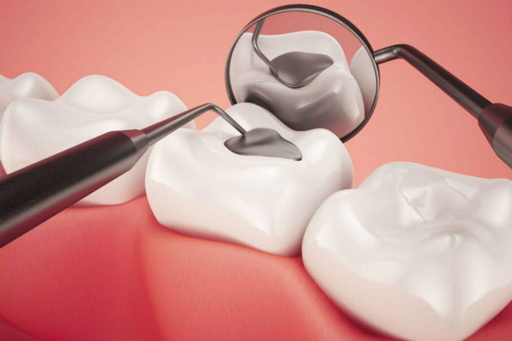 odontología consevadora